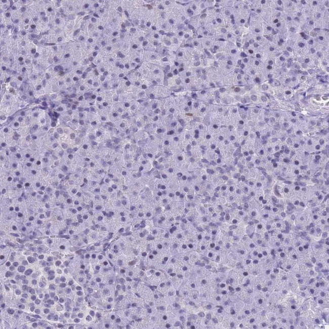 NASP Antibody in Immunohistochemistry (IHC)