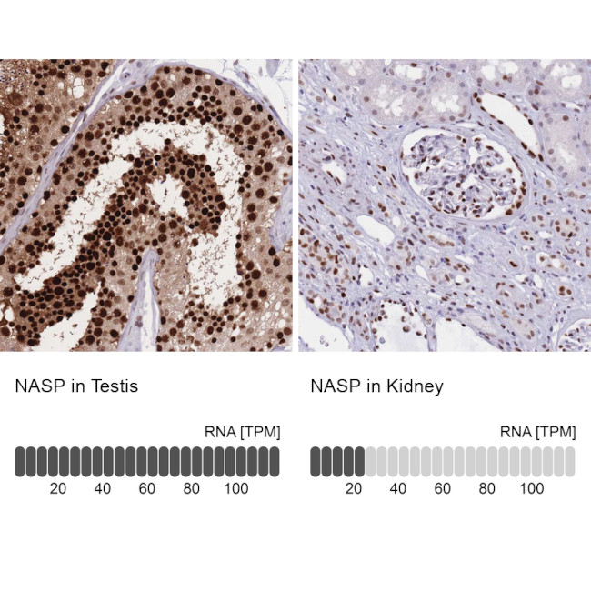 NASP Antibody in Immunohistochemistry (IHC)