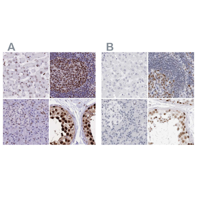 NASP Antibody in Immunohistochemistry (IHC)