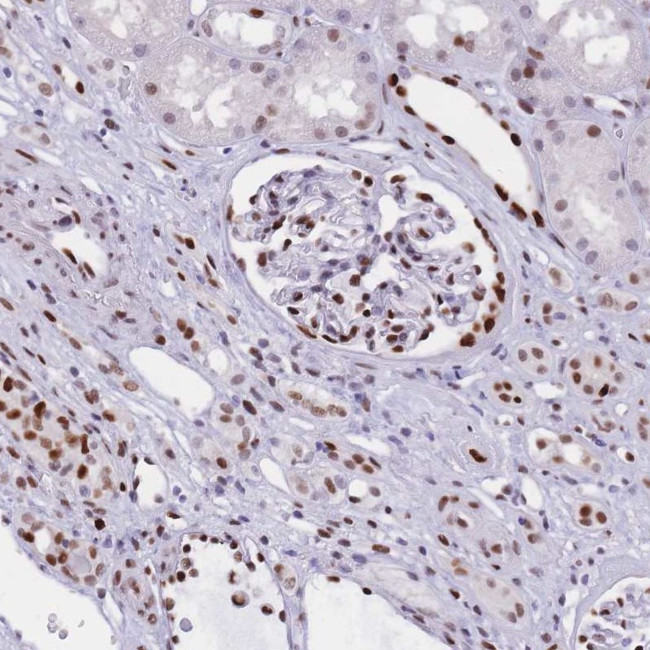 NASP Antibody in Immunohistochemistry (IHC)