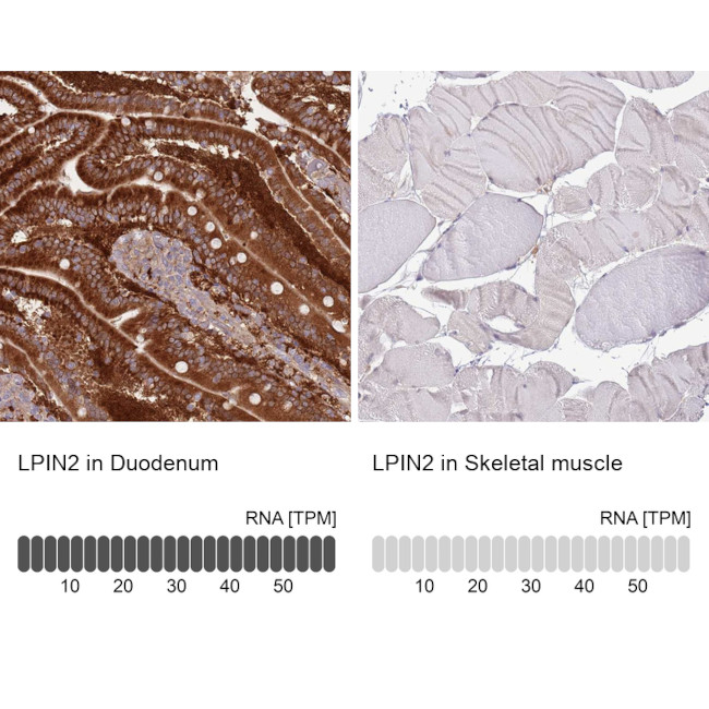 LPIN2 Antibody in Immunohistochemistry (IHC)