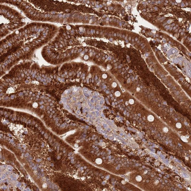 LPIN2 Antibody in Immunohistochemistry (IHC)