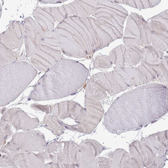 LPIN2 Antibody in Immunohistochemistry (IHC)