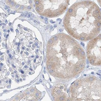 UFL1 Antibody in Immunohistochemistry (IHC)