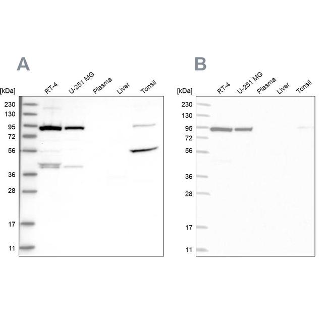 UFL1 Antibody in Western Blot (WB)