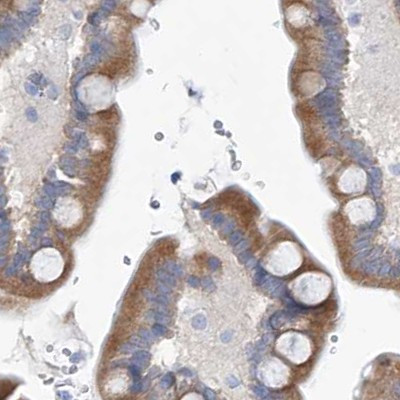 UFL1 Antibody in Immunohistochemistry (IHC)