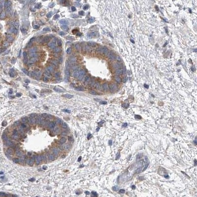 UFL1 Antibody in Immunohistochemistry (IHC)