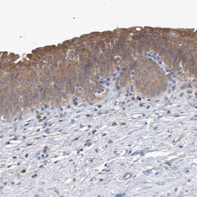 UFL1 Antibody in Immunohistochemistry (IHC)