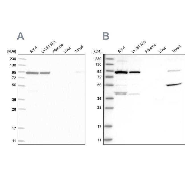 UFL1 Antibody in Western Blot (WB)