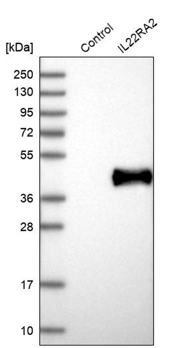 IL22RA2 Antibody in Western Blot (WB)