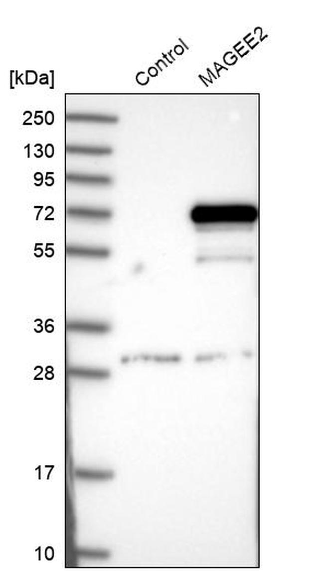 MAGEE2 Antibody in Western Blot (WB)