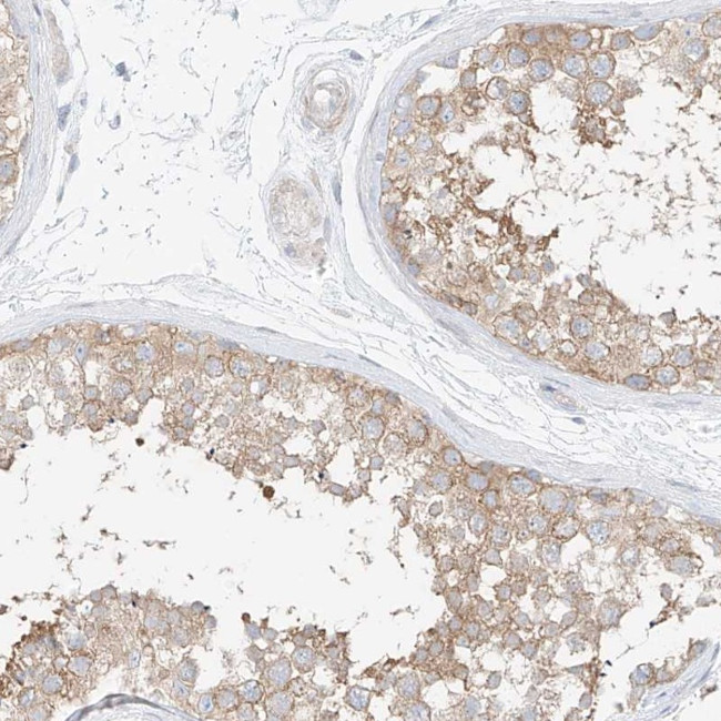 SAPS2 Antibody in Immunohistochemistry (IHC)