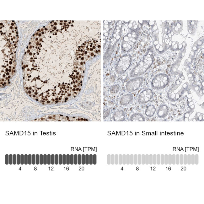 SAMD15 Antibody in Immunohistochemistry (IHC)