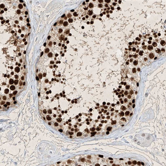 SAMD15 Antibody in Immunohistochemistry (IHC)