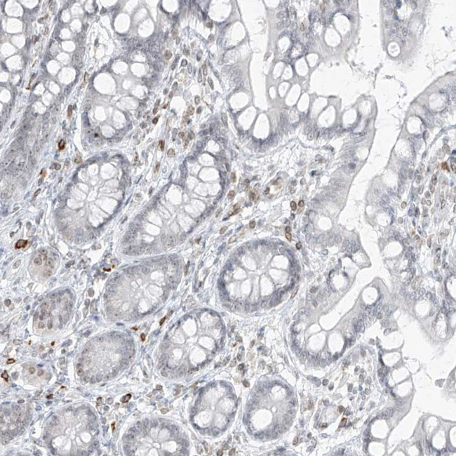 SAMD15 Antibody in Immunohistochemistry (IHC)