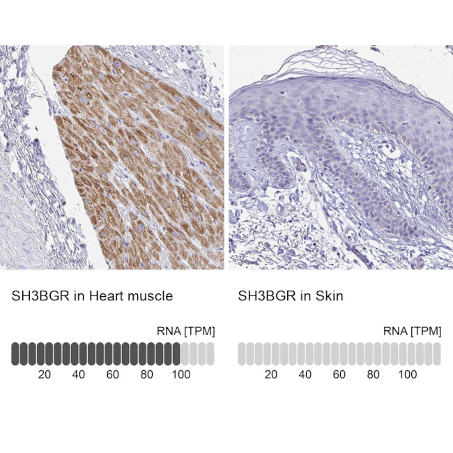 SH3BGR Antibody in Immunohistochemistry (IHC)