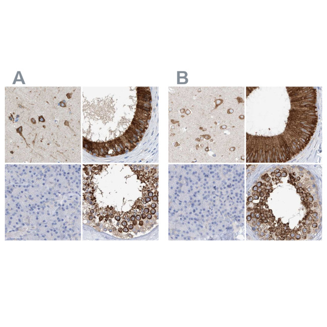 RCN2 Antibody in Immunohistochemistry (IHC)