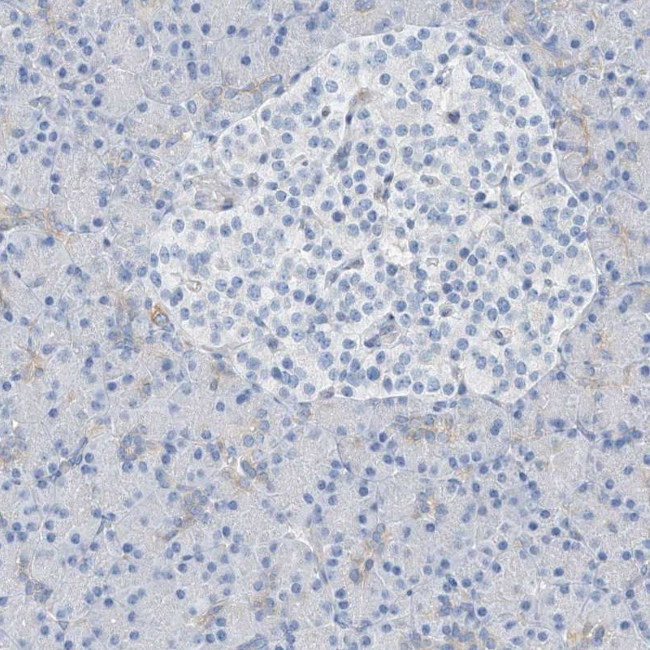 RCN2 Antibody in Immunohistochemistry (IHC)