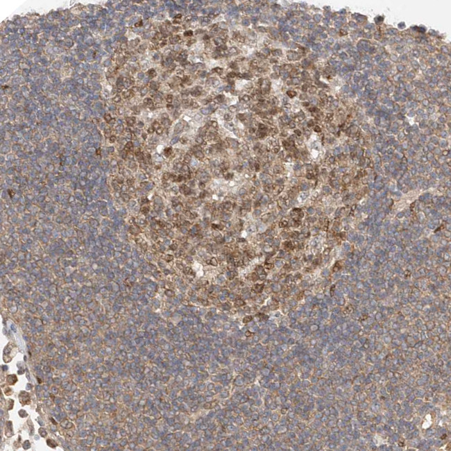 MKL1 Antibody in Immunohistochemistry (IHC)