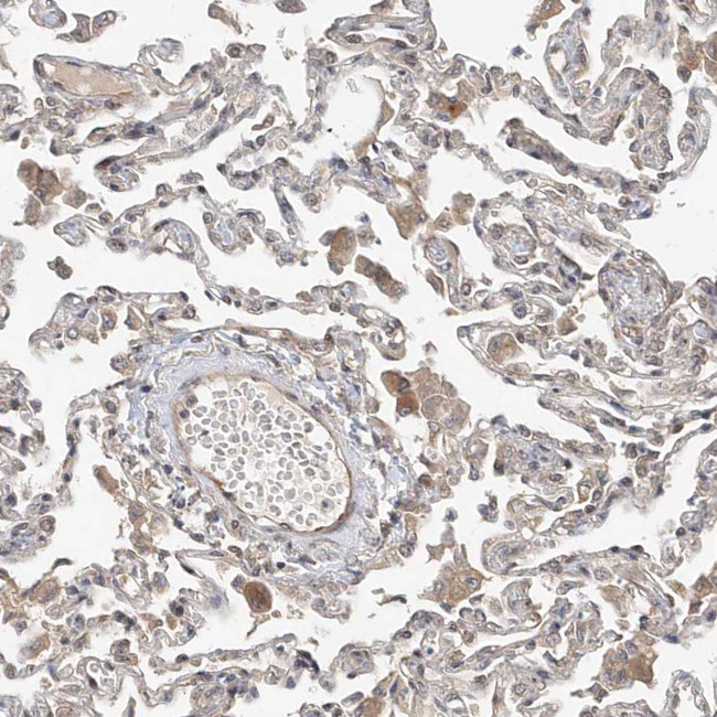 MKL1 Antibody in Immunohistochemistry (IHC)