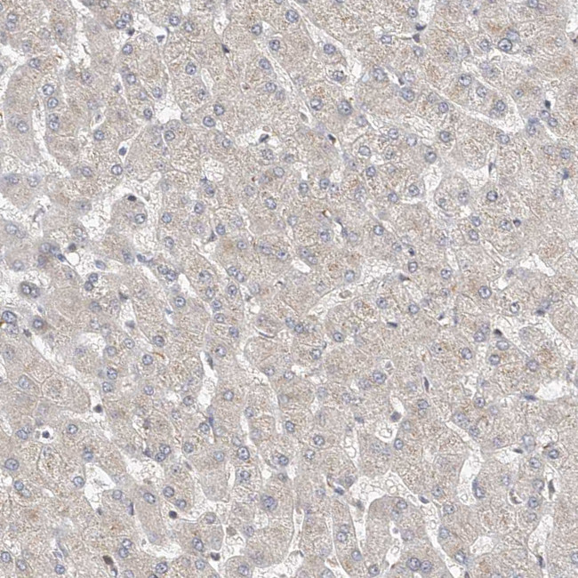 MKL1 Antibody in Immunohistochemistry (IHC)