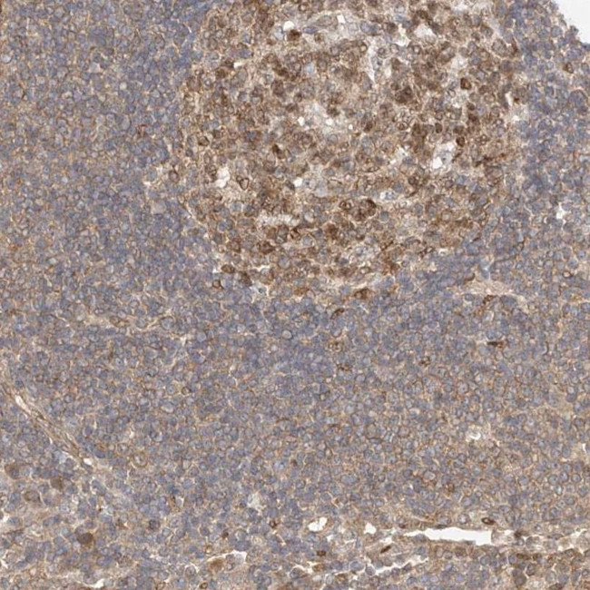 MKL1 Antibody in Immunohistochemistry (IHC)