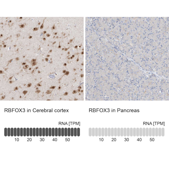 NeuN Antibody in Immunohistochemistry (IHC)