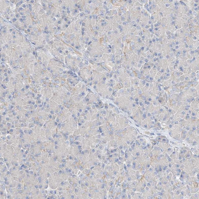 NeuN Antibody in Immunohistochemistry (IHC)