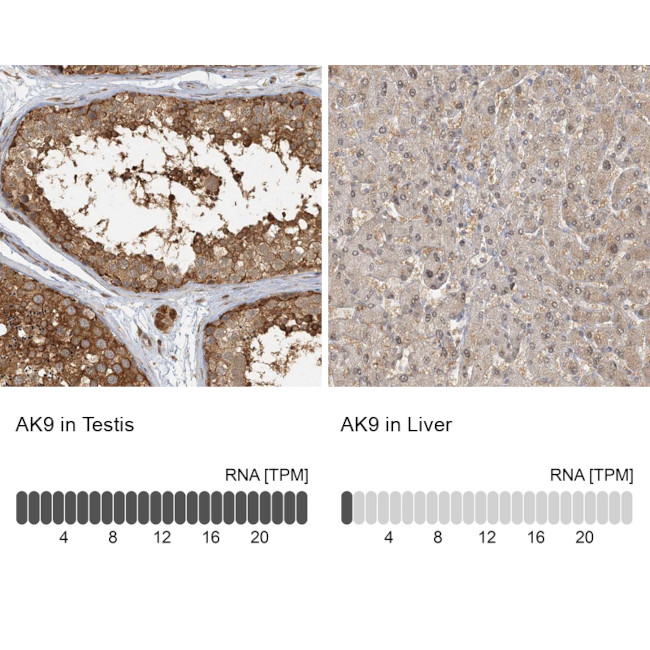 Adenylate Kinase 9 Antibody in Immunohistochemistry (IHC)