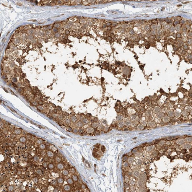 Adenylate Kinase 9 Antibody in Immunohistochemistry (IHC)