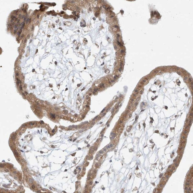 TASP1 Antibody in Immunohistochemistry (IHC)