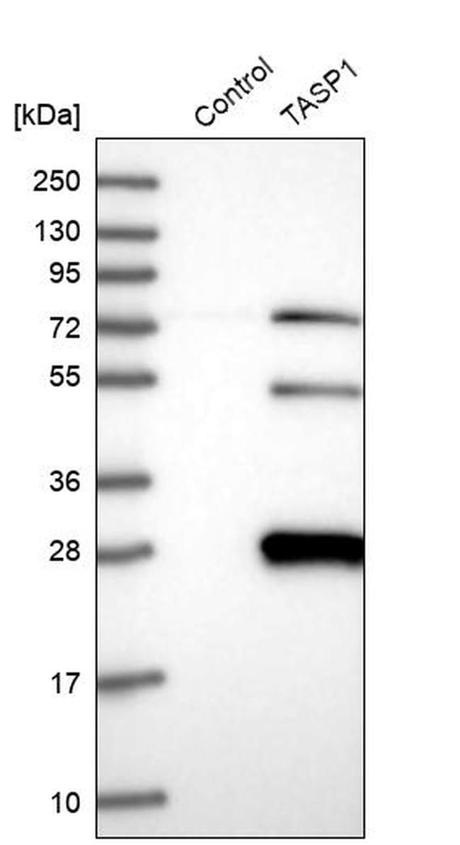 TASP1 Antibody in Western Blot (WB)