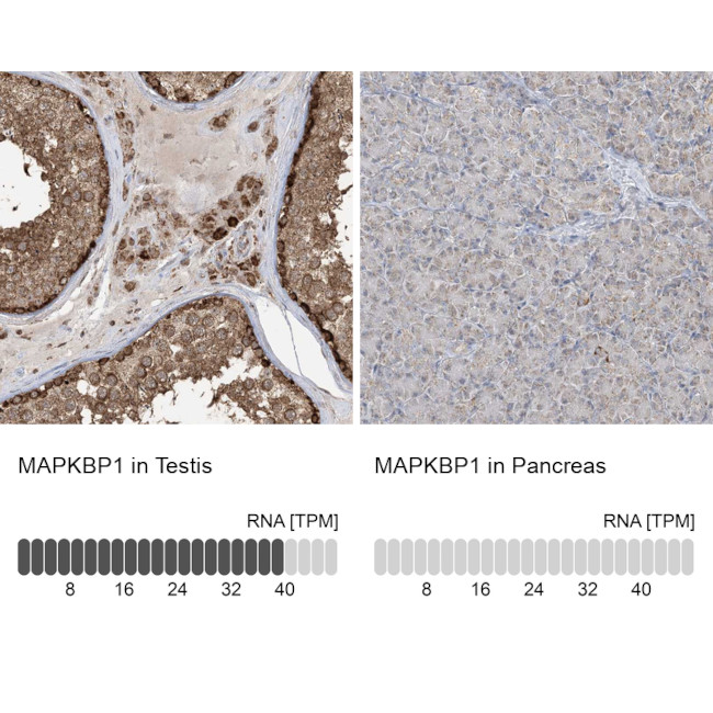 MAPKBP1 Antibody in Immunohistochemistry (IHC)