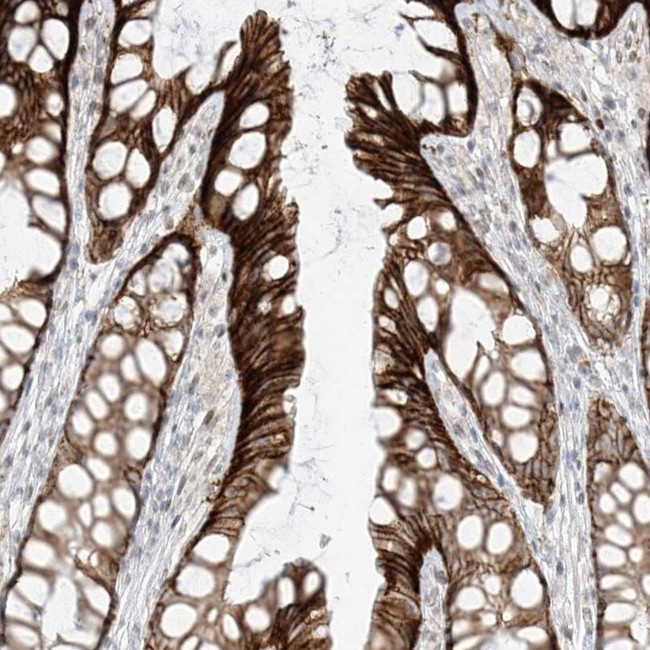 ZNF774 Antibody in Immunohistochemistry (IHC)