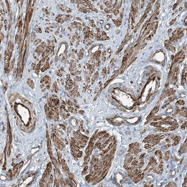 SH3BGRL3 Antibody in Immunohistochemistry (IHC)