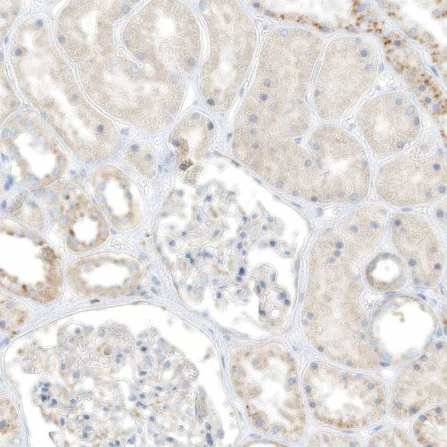 TAL2 Antibody in Immunohistochemistry (IHC)