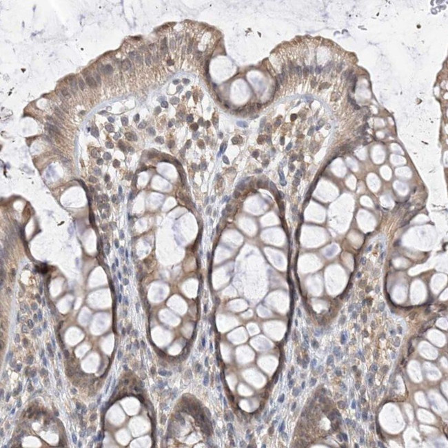 PPA2 Antibody in Immunohistochemistry (IHC)