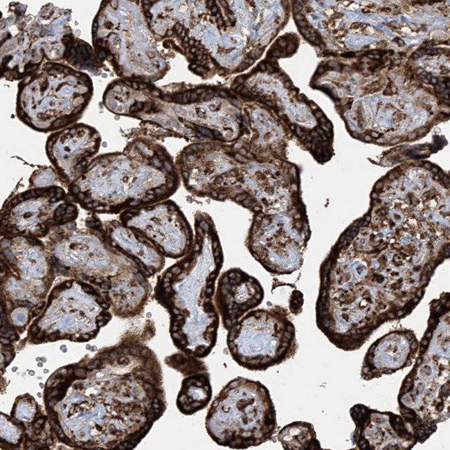 MX1 Antibody in Immunohistochemistry (IHC)