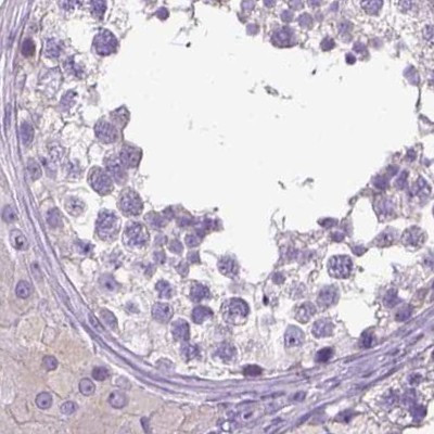 LGSN Antibody in Immunohistochemistry (IHC)