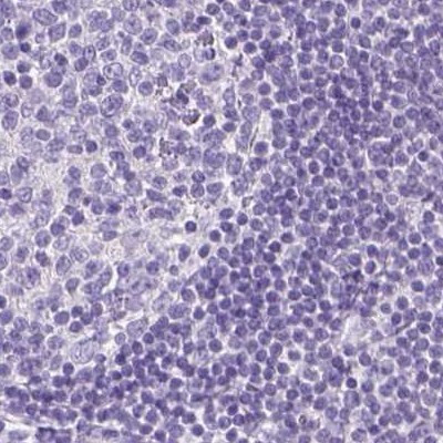 LGSN Antibody in Immunohistochemistry (IHC)