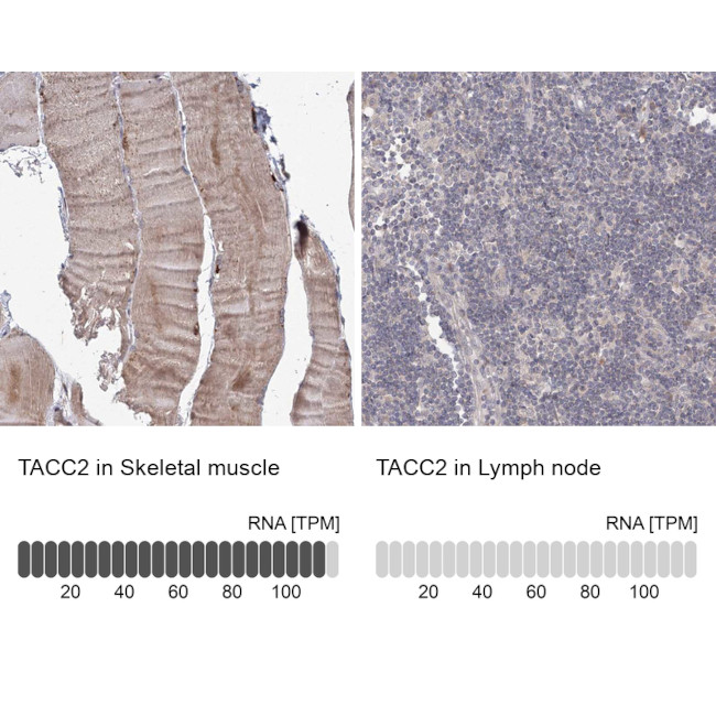 TACC2 Antibody