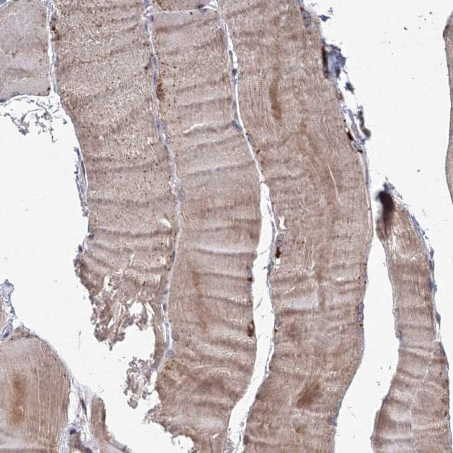 TACC2 Antibody in Immunohistochemistry (IHC)