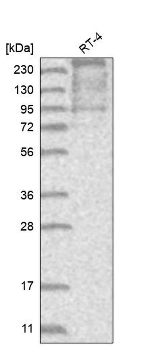 TACC2 Antibody in Western Blot (WB)