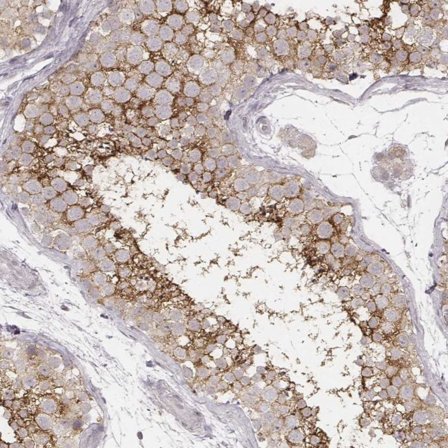 SLC7A4 Antibody in Immunohistochemistry (IHC)