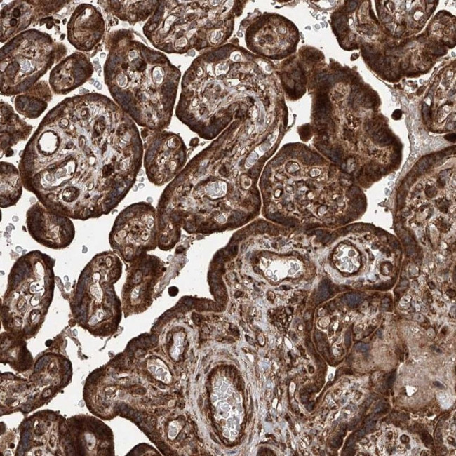 PISD Antibody in Immunohistochemistry (IHC)