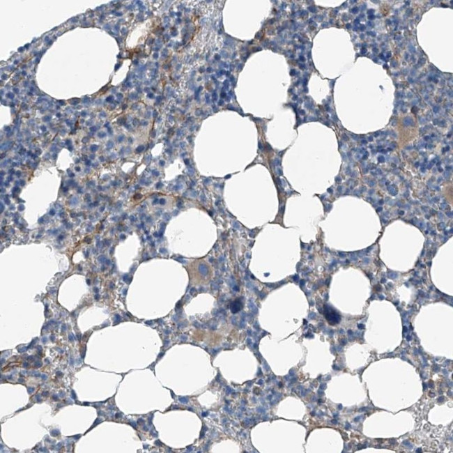 ICB-1 Antibody in Immunohistochemistry (IHC)