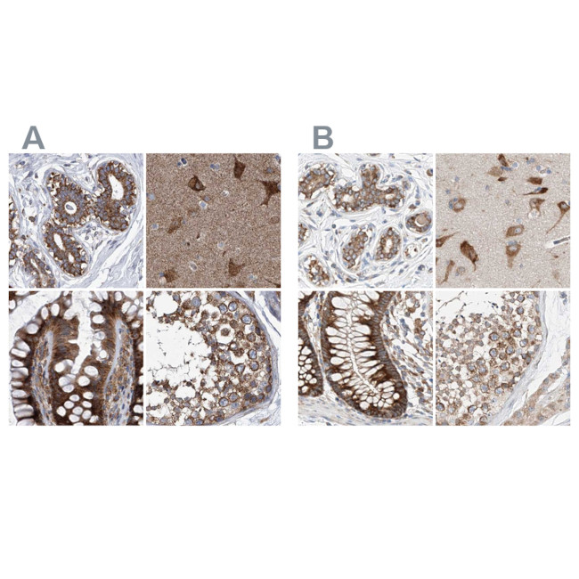 ZC3H15 Antibody in Immunohistochemistry (IHC)