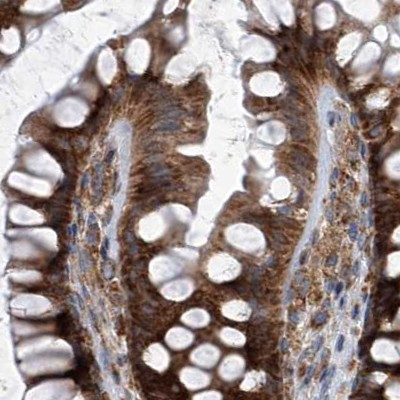 ZC3H15 Antibody in Immunohistochemistry (IHC)