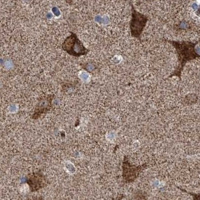 ZC3H15 Antibody in Immunohistochemistry (IHC)