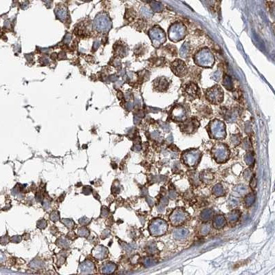 ZC3H15 Antibody in Immunohistochemistry (IHC)